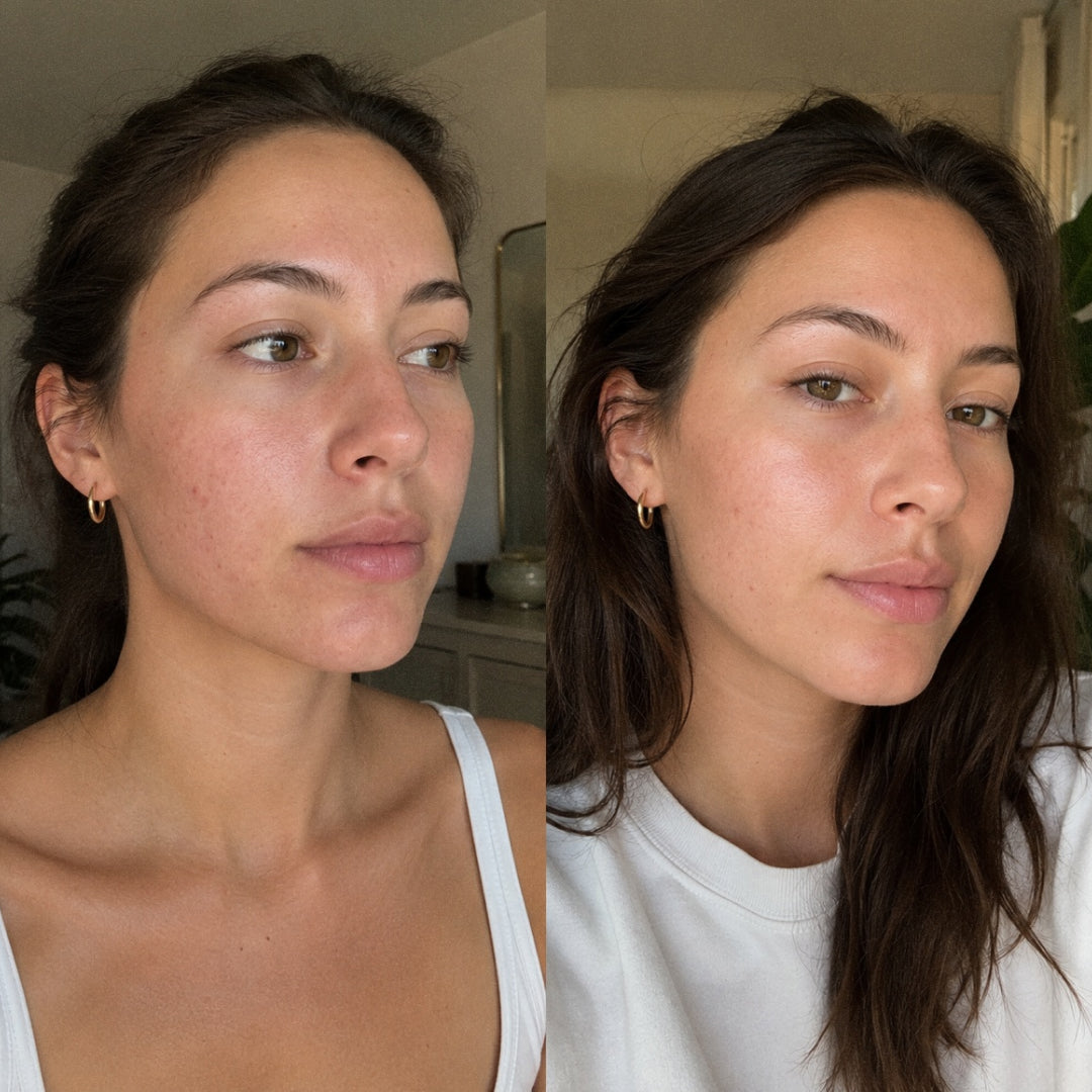 Red Light Therapy Mask